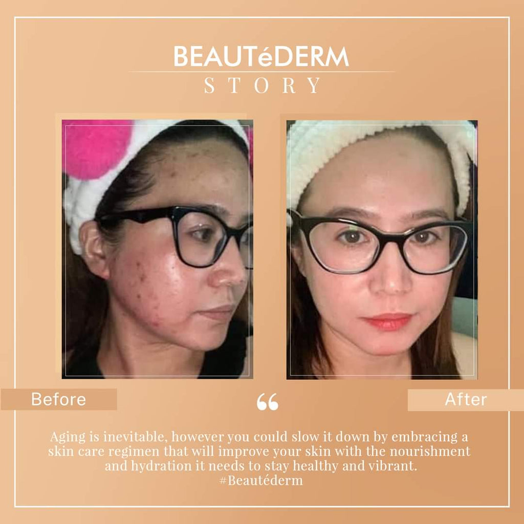 Beautederm jaz beautedebox