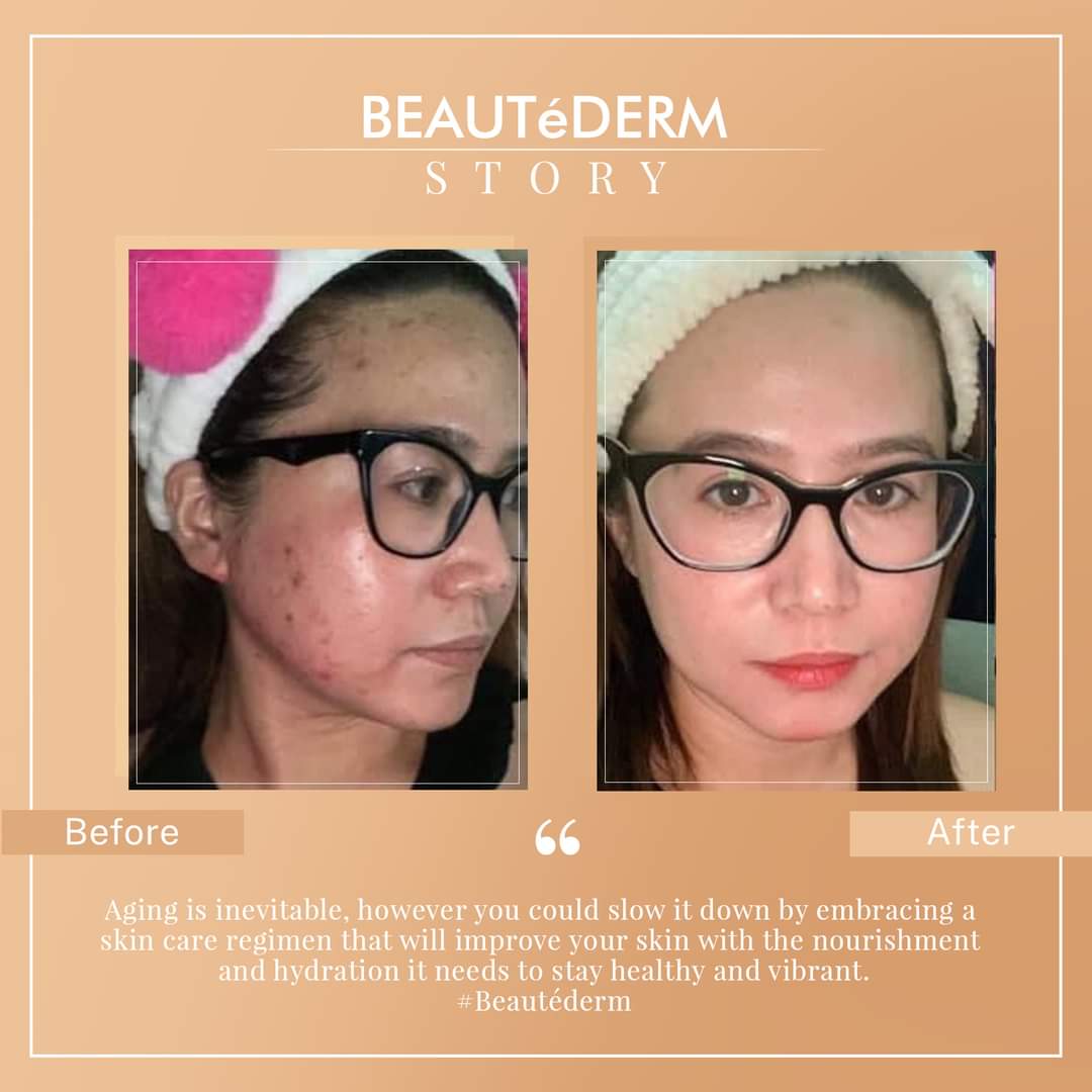 Beautederm jaz beautedebox