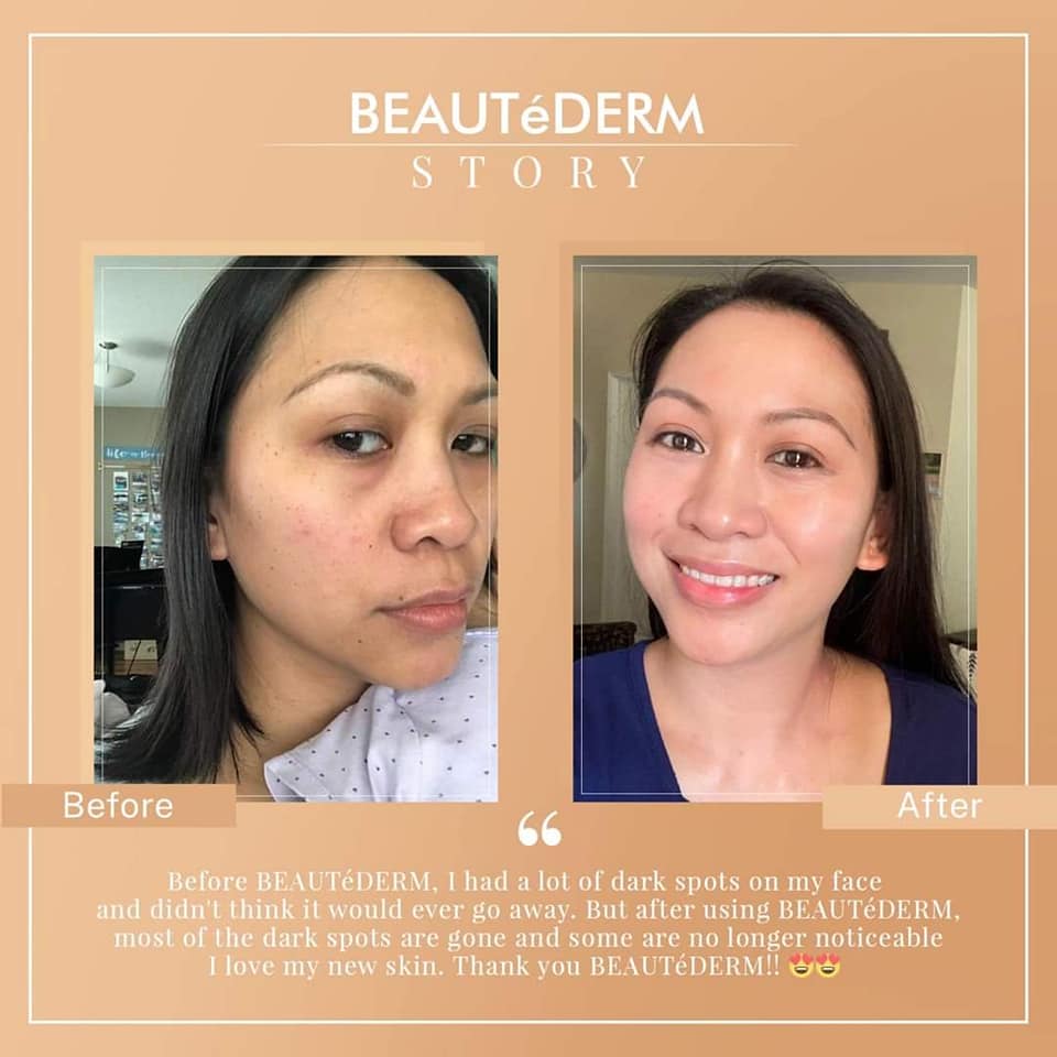 Premium Set (4 Months Use)