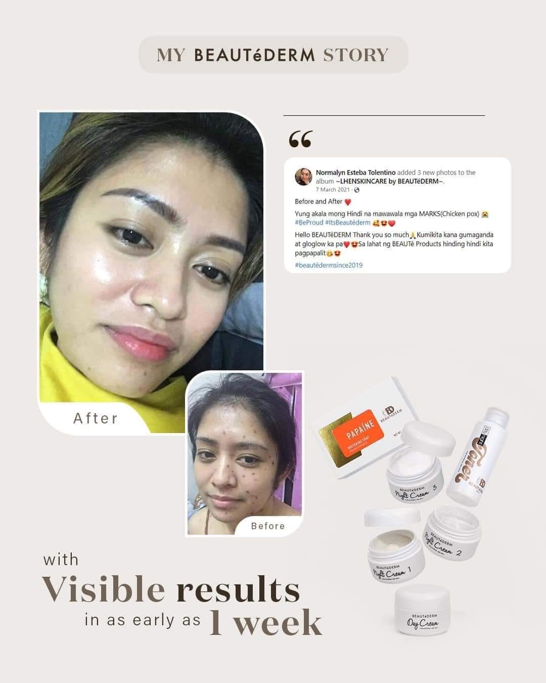 Regular Set (2 Months Use)